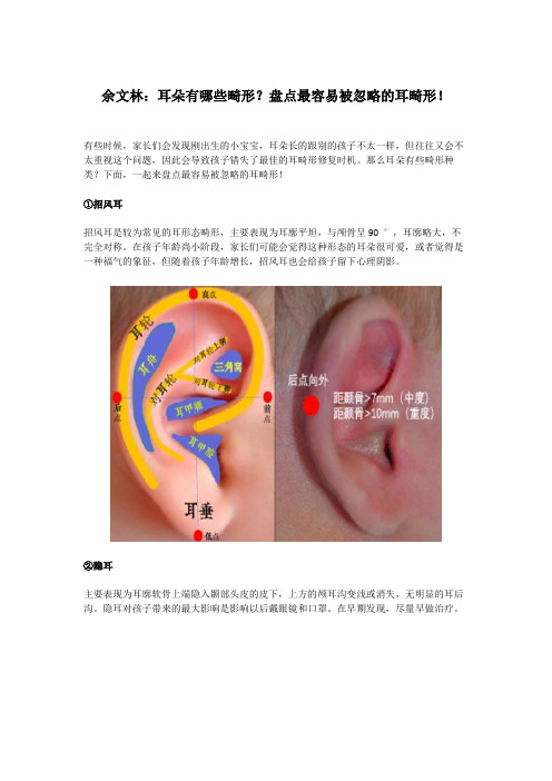 耳朵有哪些畸形？盘点最容易被忽略的耳畸形!