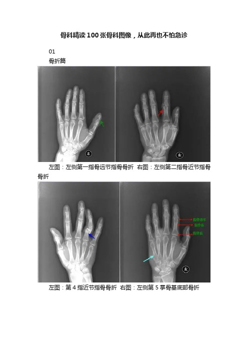 骨科精读100张骨科图像，从此再也不怕急诊