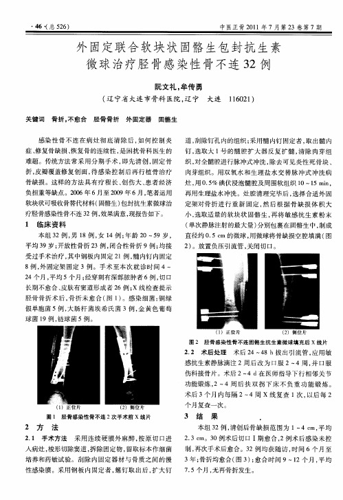 外固定联合软块状固骼生包封抗生素微球治疗胫骨感染性骨不连32例