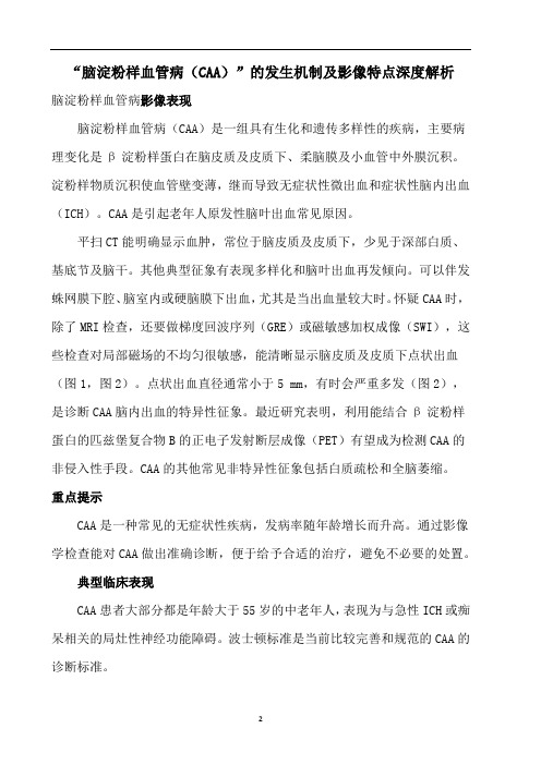 “脑淀粉样血管病(CAA)”的发生机制及影像特点深度解析