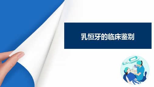 乳牙及年轻恒牙的解剖形态与组织结构特点 乳恒牙的临床鉴别