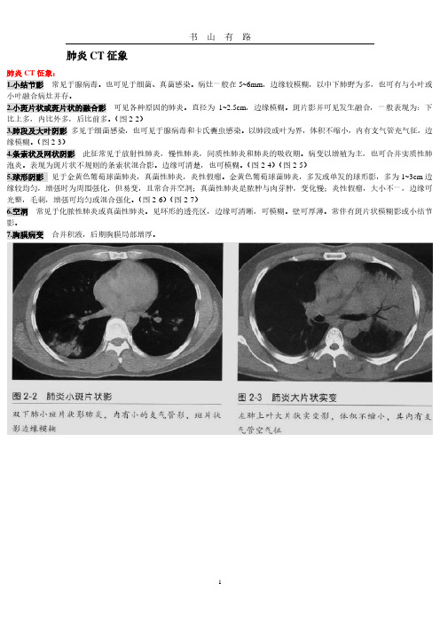 肺炎CT征象资料PDF.pdf