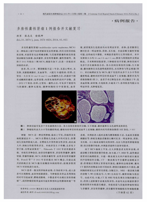 多房性囊性肾瘤1例报告并文献复习