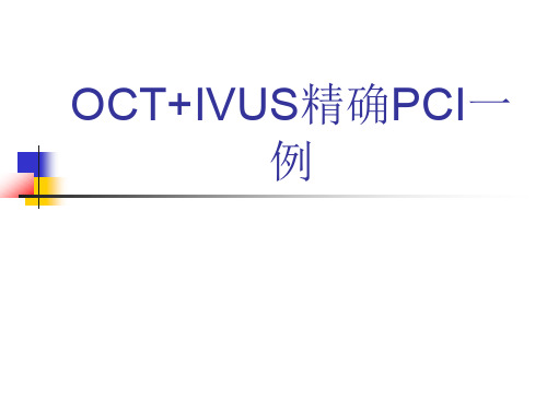 IVUS联合OCT精确PCI1例