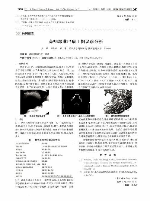 鼻咽部淋巴瘤1例误诊分析