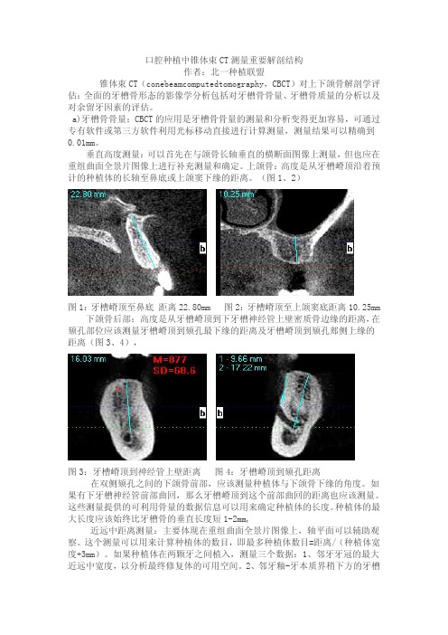 口腔种植中CBCT测量重要解剖结构图文版1