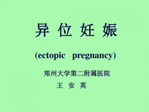 异位妊娠