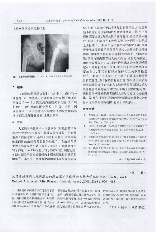 应用于经椎间孔椎间融合的融合器不同设计的生物力学比较研究