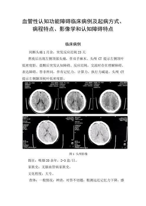 血管性认知功能障碍临床病例及起病方式、病程特点、影像学和认知障碍特点