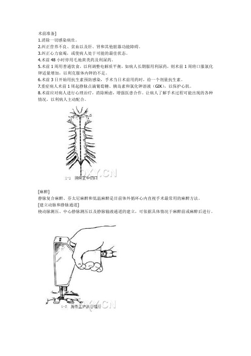 体外循环建立步骤