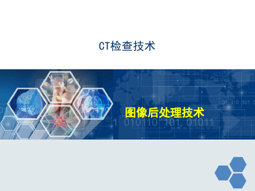 图像后处理技术CT检查技术