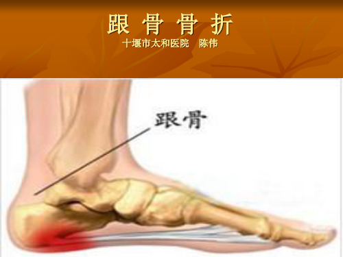 跟骨骨折护理PPT幻灯片