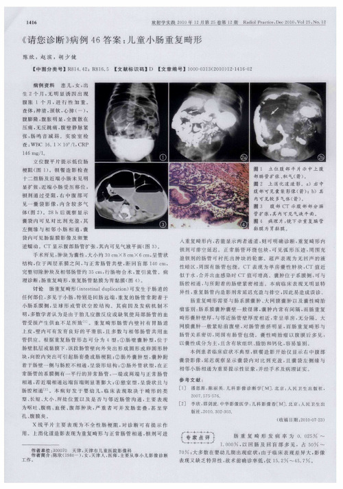 《请您诊断》病例46答案：儿童小肠重复畸形