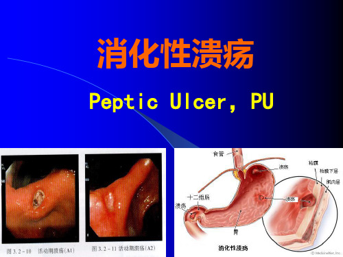 临床医学概要—消化