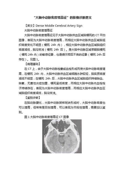 “大脑中动脉密度增高征”的影像诊断意义