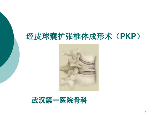 经皮球囊扩张椎体成形术(PKP)PPT课件