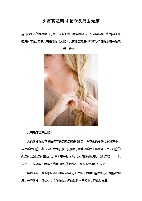 头屑高发期 4招令头屑去无踪