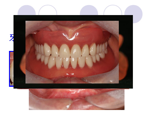 口腔医学修复科：牙列缺失的全口义齿修复