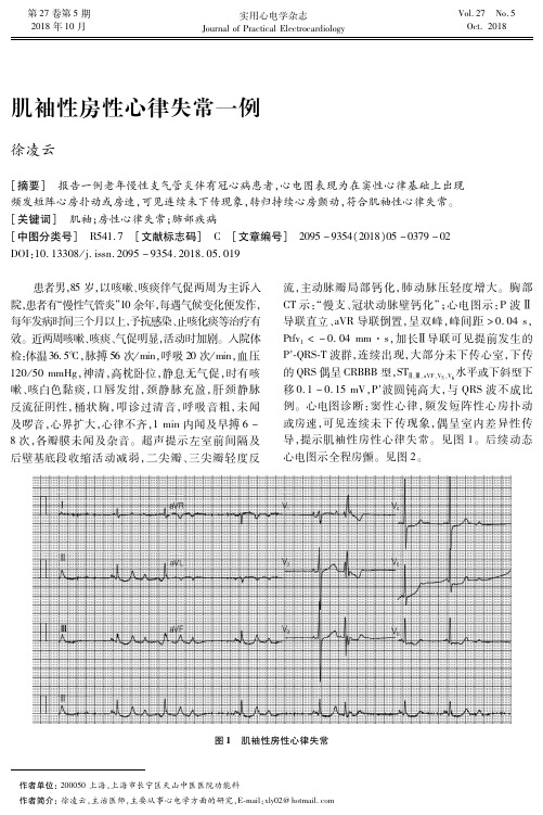 肌袖性房性心律失常一例