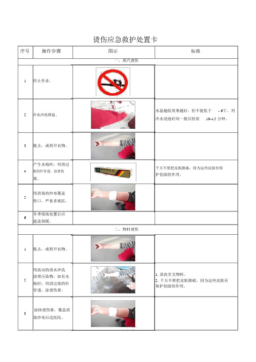 烫伤应急救护处置卡