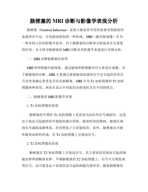 脑梗塞的MRI诊断与影像学表现分析