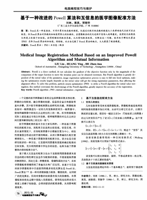 基于一种改进的Powell算法和互信息的医学图像配准方法