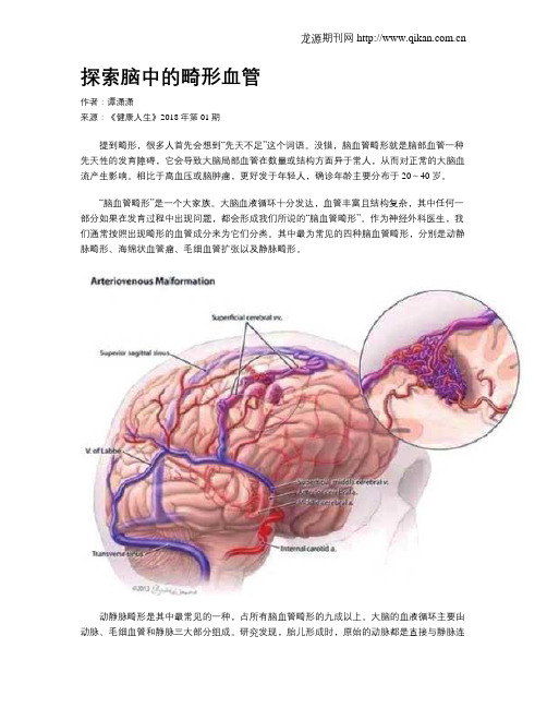 探索脑中的畸形血管