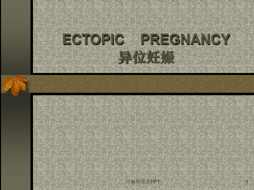 异位妊娠ppt课件