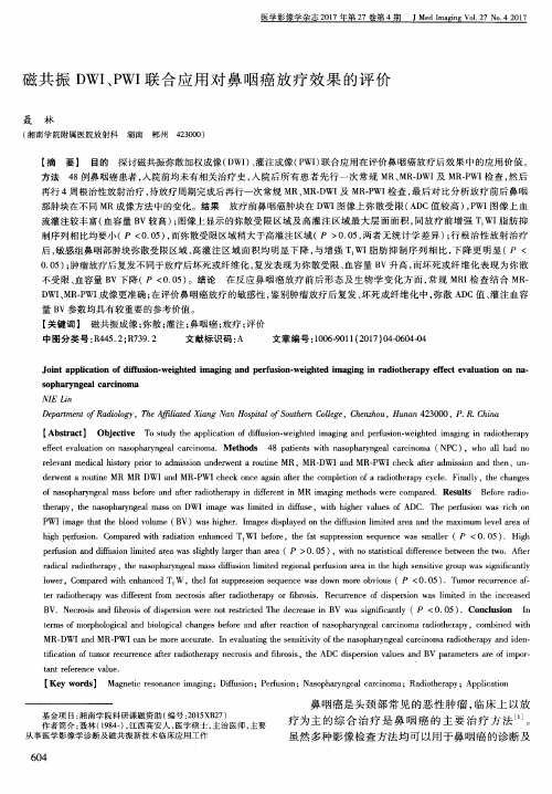 磁共振DWI、PWI联合应用对鼻咽癌放疗效果的评价