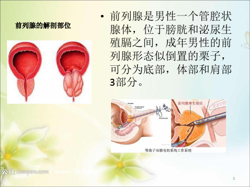 前列腺电切术TURPPPT课件