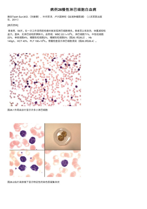 病例26慢性淋巴细胞白血病