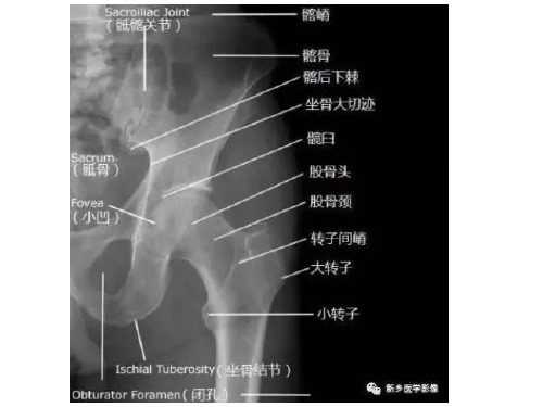 髋关节X线解剖+摄影技术+测量方法