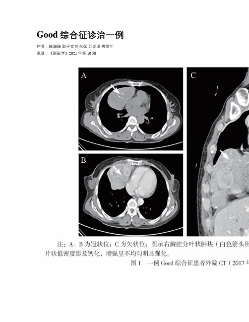 Good综合征诊治一例