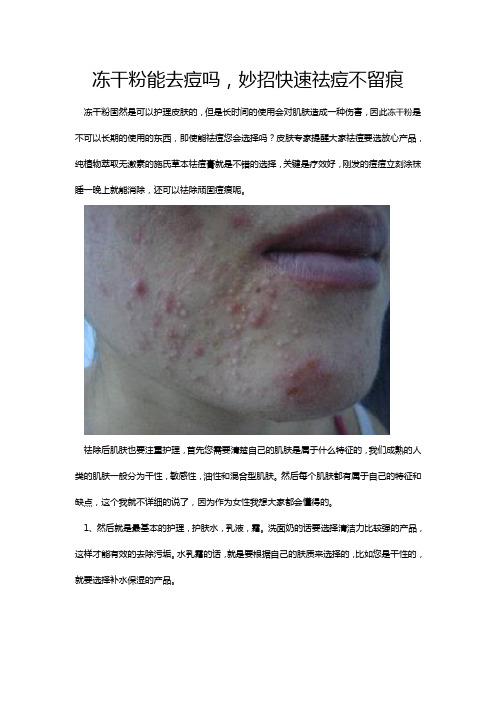 冻干粉能去痘吗,妙招快速祛痘不留痕