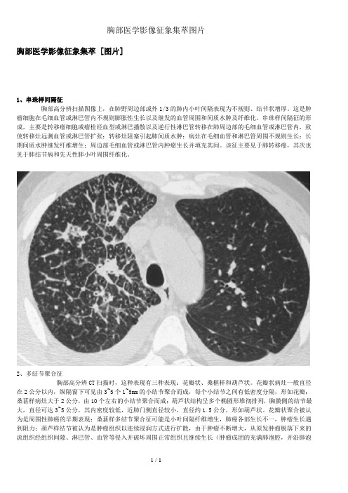 胸部医学影像征象集萃图片