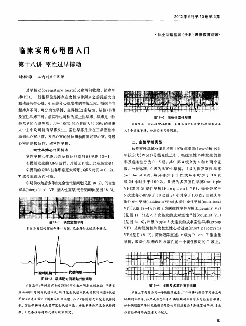 临床实用心电图入门  第十八讲  室性过早搏动