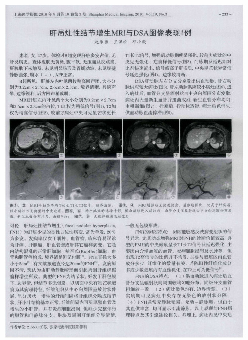 肝局灶性结节增生MRI与DSA图像表现1例