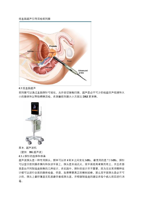 经直肠超声引导活检前列腺的方法及风险分析