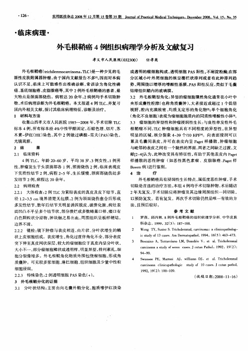 外毛根鞘癌4例组织病理学分析及文献复习