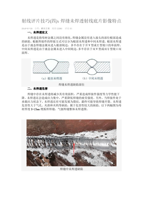 射线评片技巧(四)：焊缝未焊透射线底片影像特点