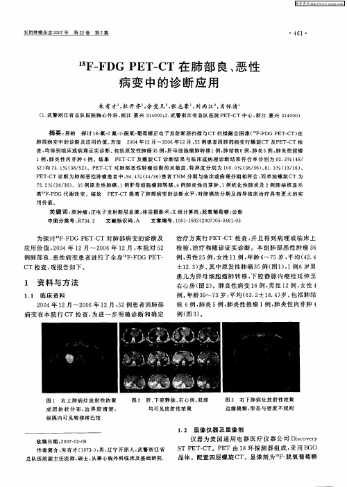 18F-FDG PET-CT在肺部良、恶性病变中的诊断应用