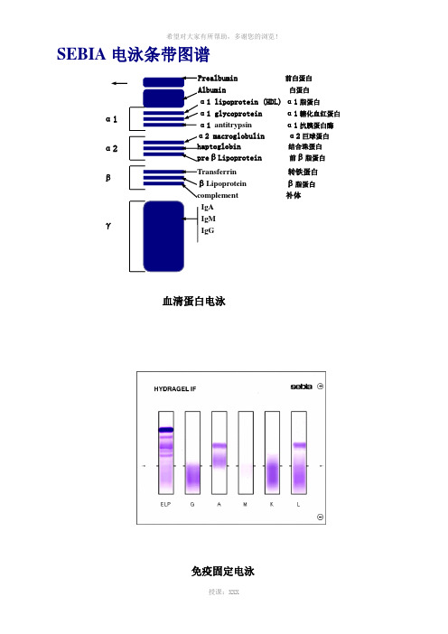 电泳条带图