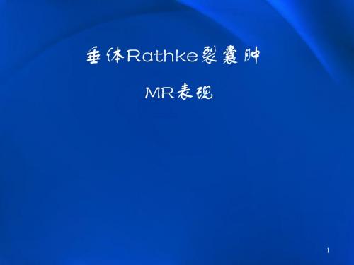 垂体Rathke裂囊肿MR表现ppt课件