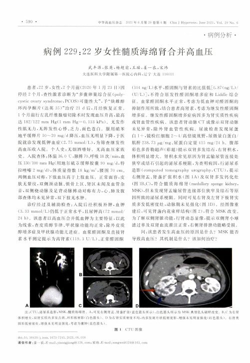 病例229:22岁女性髓质海绵肾合并高血压