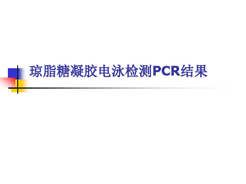 琼脂糖凝胶电泳检测PCR结果1