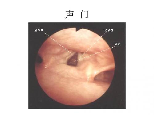 纤维支气管镜图谱(精)