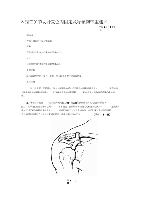 肩锁关节切开复位内固定及喙锁韧带重建术