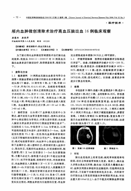 颅内血肿微创清除术治疗高血压脑出血16例临床观察