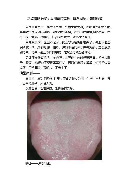 功能障碍医案：重用黄芪党参，脾肾同补，效如桴鼓