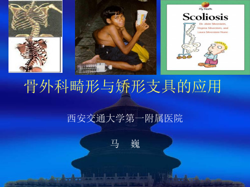 侧弯,儿麻分析